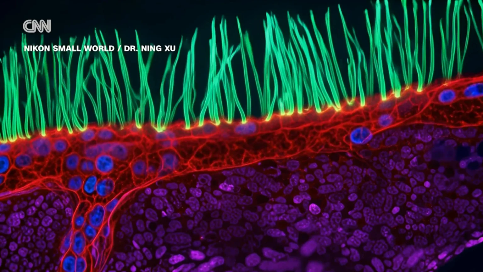 Microscope image showing green hairlike structures above red and purple tissue, with a CNN logo and the text “Nikon Small World / Dr. Ning Xu.”
